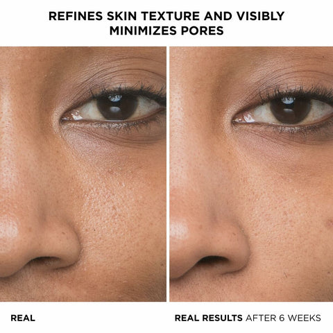 V4HF2281436D8A6B60CE932DF778EB98B34R6238555P2